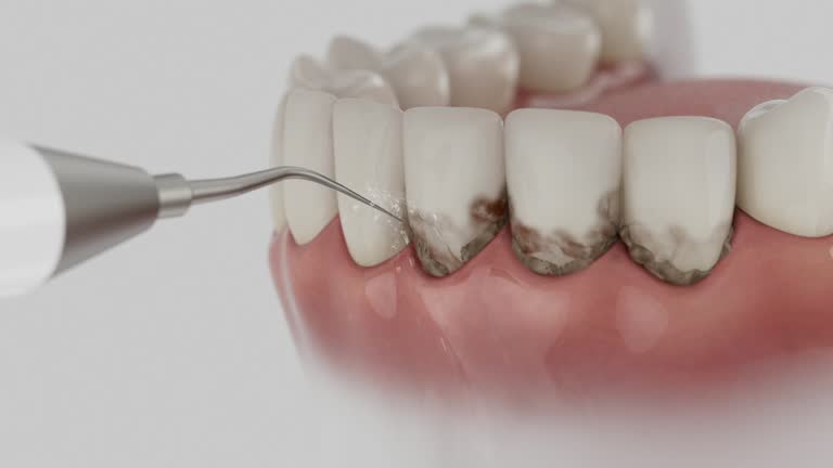 Trusted Dental Implants service in Princess Anne, MD - Dentist Open Now